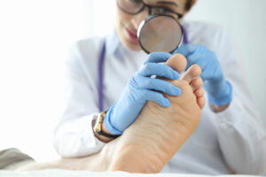 5 solutions naturelles et efficaces pour traiter la mycose des pieds.
