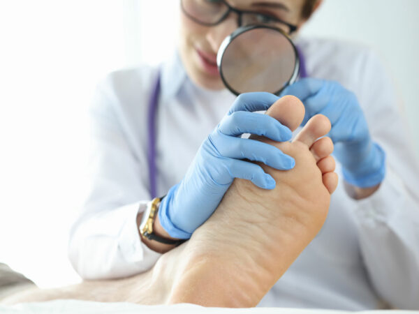 5 solutions naturelles et efficaces pour traiter la mycose des pieds.