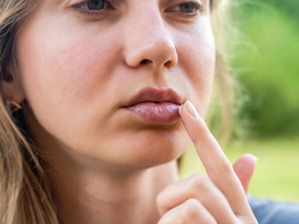 Vos lèvres sont gercées Voici les 5 mauvaises habitudes à éviter absolument !
