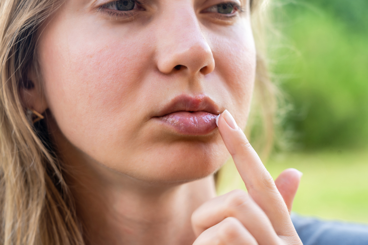 Vos lèvres sont gercées Voici les 5 mauvaises habitudes à éviter absolument !