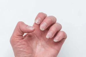 Voici ce que l'apparence de vos ongles peut révéler sur votre état de santé