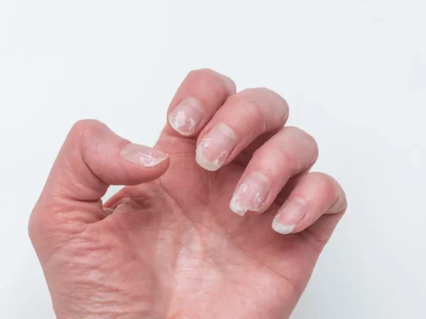 Voici ce que l'apparence de vos ongles peut révéler sur votre état de santé