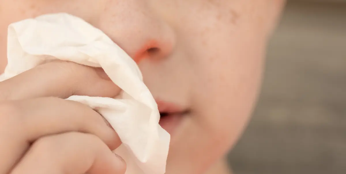 Nez irrité par le rhume : 4 remèdes de grand-mère