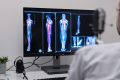 Arthrose du genou : la radiothérapie réduit le risque de handicap de 67%